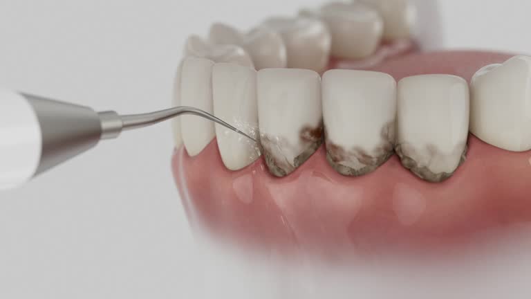 Trusted Dental Crowns And Bridges service in Hanover, PA - Dentist Open Now